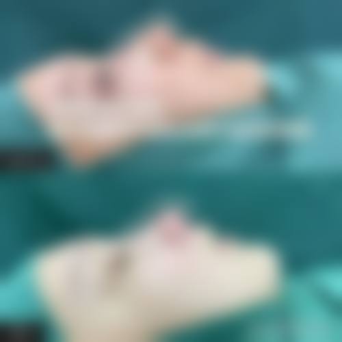 预约优惠活动:省钱变得更美指南