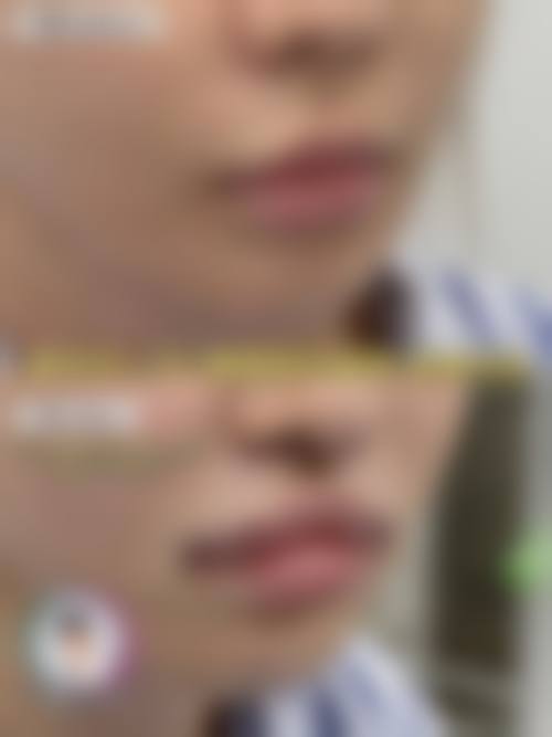 擅长项目详解
