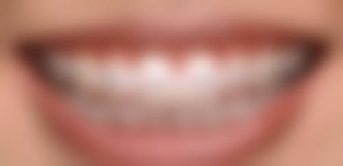 数字化精细诊疗与无菌环境保护
