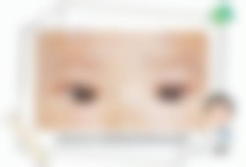 擅长项目详解：精细解决眼部困扰