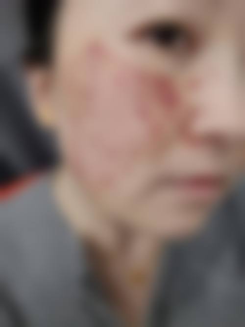 诊疗特色总结:为什么选择赵建鹏医生?