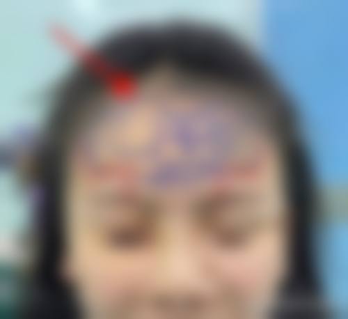 预约优惠活动:限时补贴助你轻松变得更美