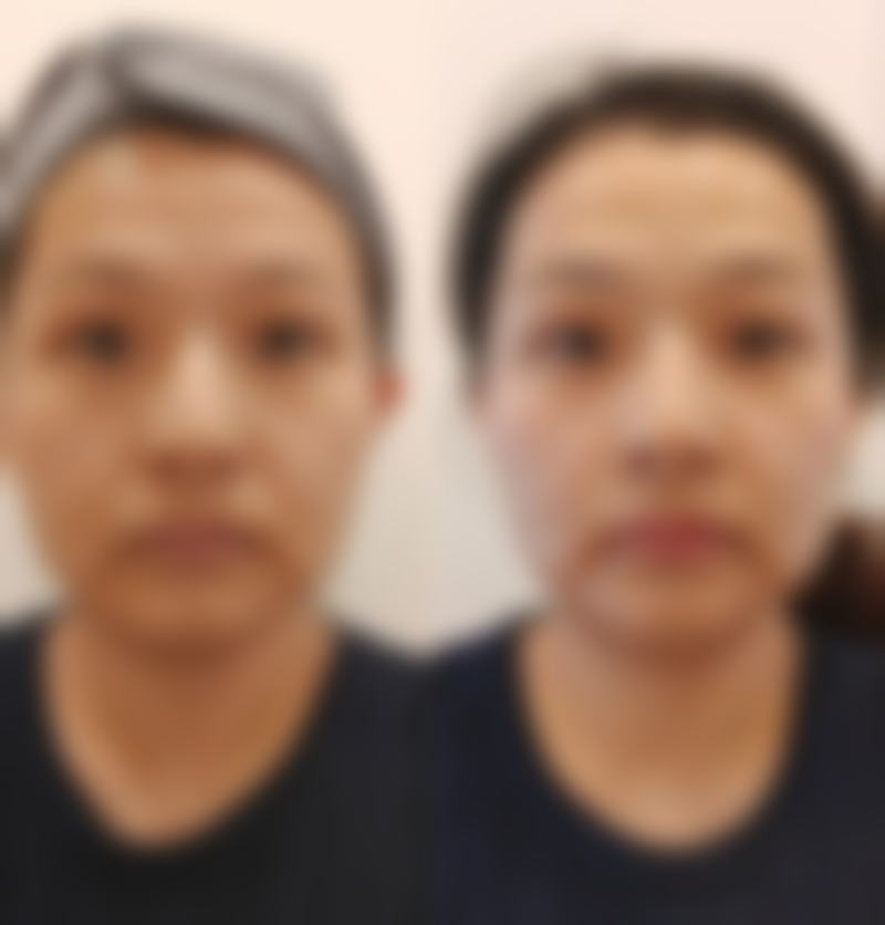 擅长项目详解韩国金钟瑞整形外科