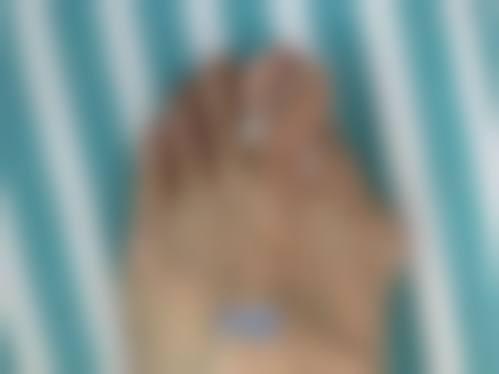 雷元清主治医师的技术亮点
