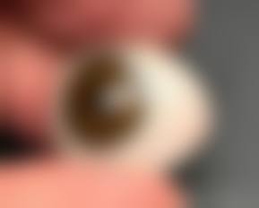 擅长项目详解:广州市妇女儿童医疗中 心眼科项道满的核心技术