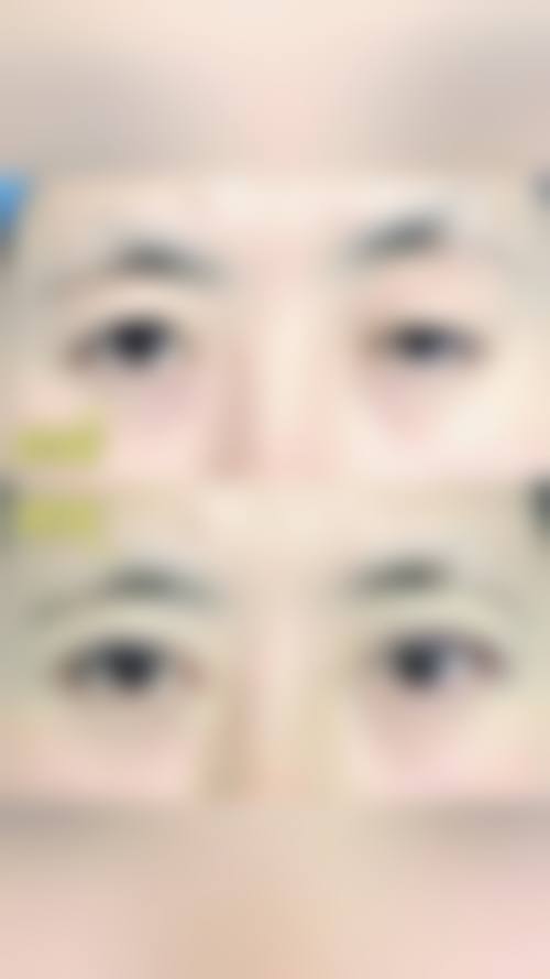 诊疗特色总结:广州市妇女儿童医疗中 心眼科项道满的服务理念