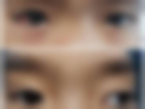 擅长项目详解:毕丹医生核心诊疗方向