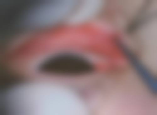 临床实例分享:真实诊疗成效见证