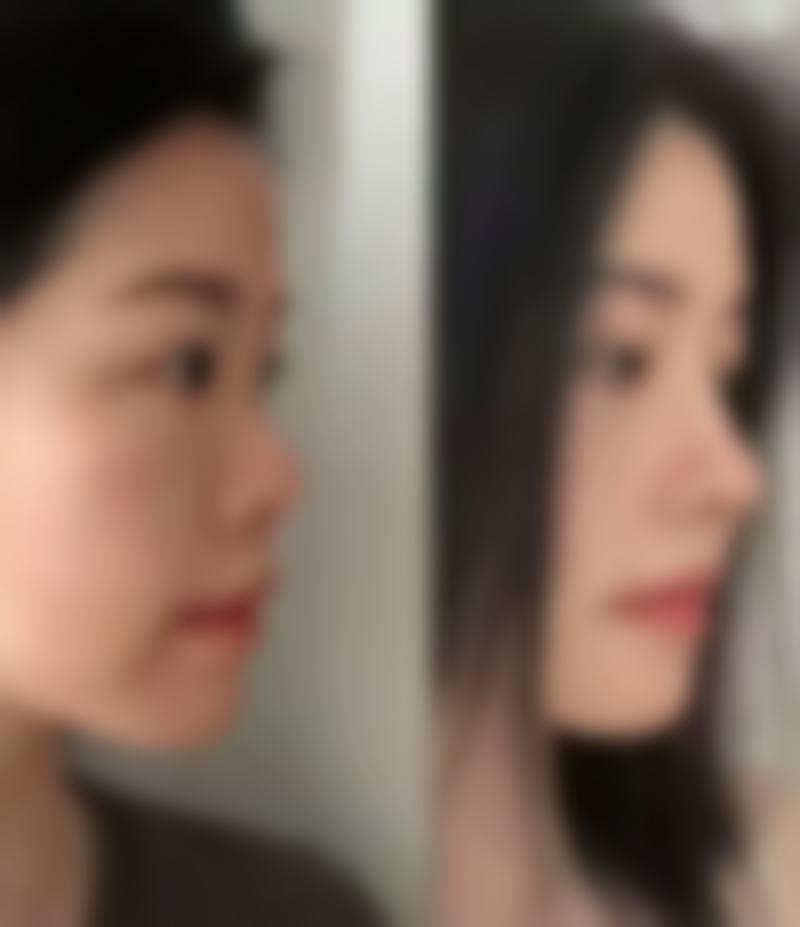 预约优惠活动