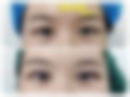 擅长项目详解：胸部整形与身体塑形的技术特色