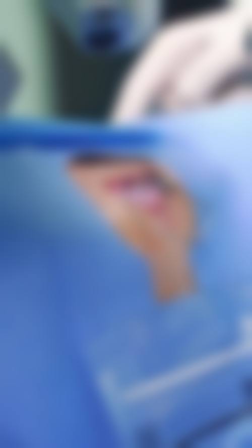 擅长项目详解