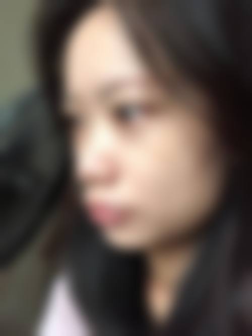 患者真实评价：谢莉+广州市妇女儿童医疗中 心眼科