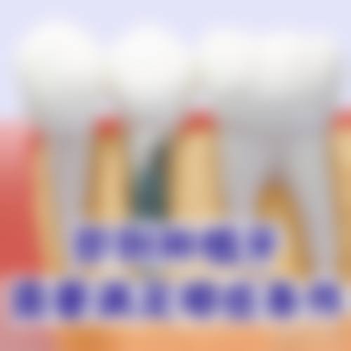 透明定价与近期优惠活动