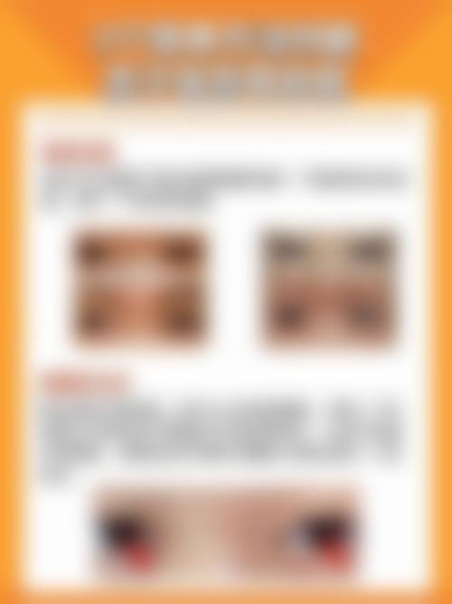 常见问题解答:患者更关心的两个疑问