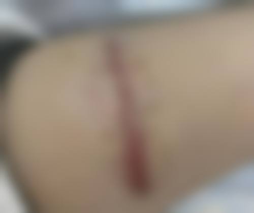 患者真实评价