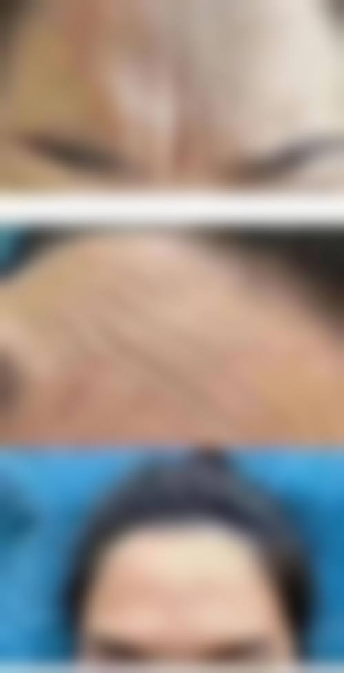 患者真实评价：姜友定医生的口碑见证