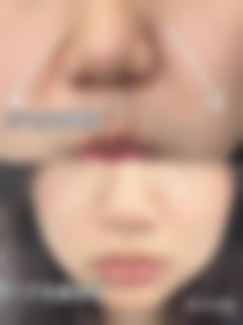 预约优惠活动：姜友定医生的专属补贴