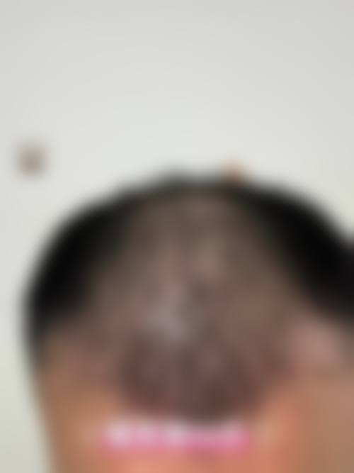 患者真实评价
