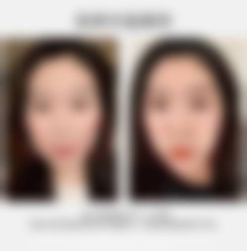诊疗特色总结：姜友定医生的独特优势
