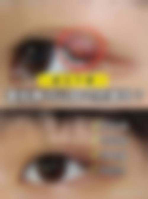 视光特色与设备优势:精细矫正视力难题