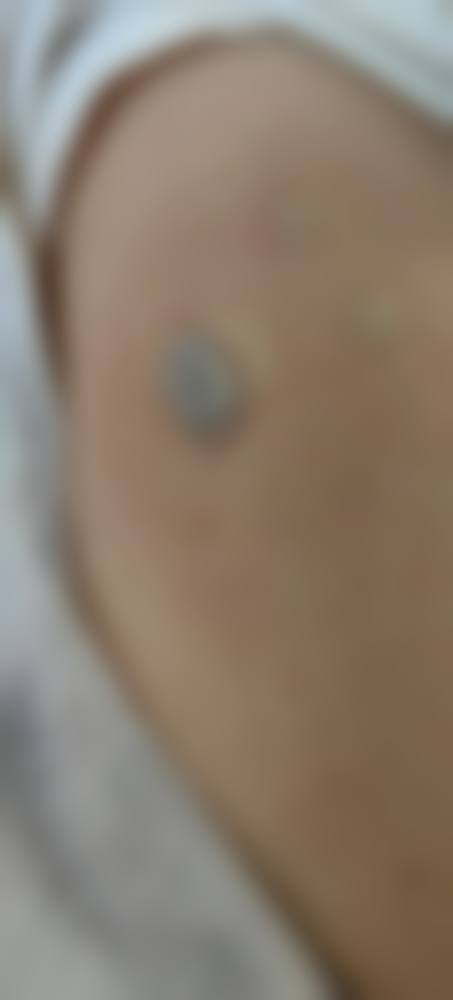患者真实评价:口碑相传的信任之选