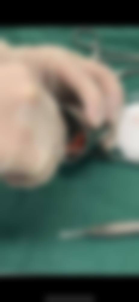 预约优惠活动:专属补贴助力美丽蜕变