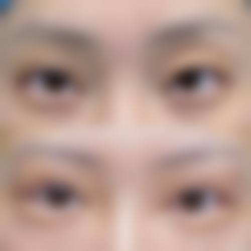 临床实例分享