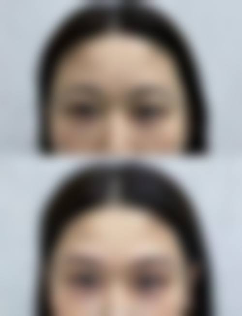 市场参考价格表与优惠补贴详情