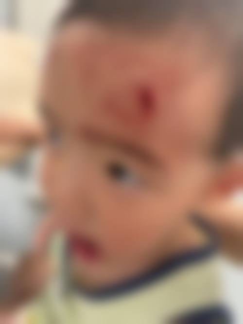 擅长项目详解:石家庄市人民医院眼科冯艳霞医生核心诊疗领域