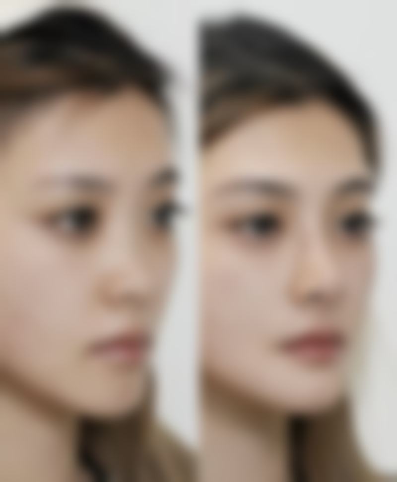 天津美联致美整形医院患者口碑评价