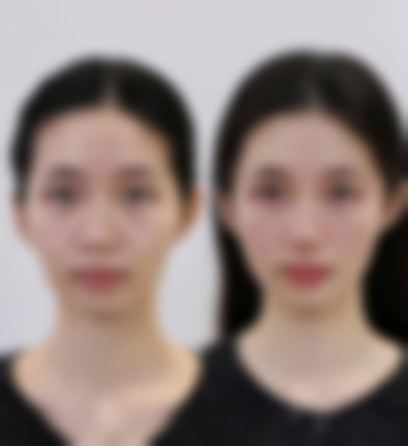 郑州熙竹医疗美容诊疗设备优势