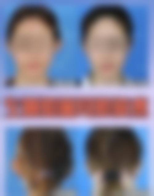 擅长项目详解