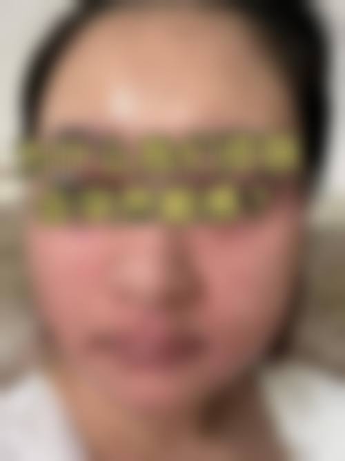 擅长项目详解