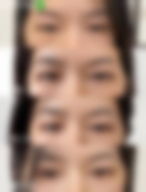 临床实例分享