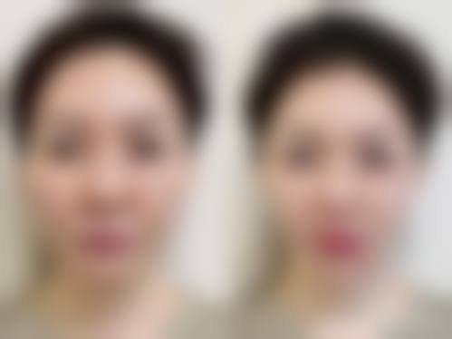 总结与预约号召