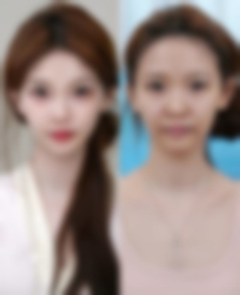 中山美星整形医院参考价格表