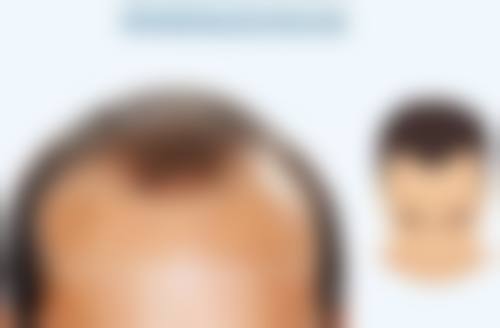下颚骨歪斜可以矫正吗？不同诱因对应不同调整方案