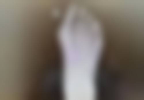 热玛吉和除皱针可以一起打吗？联合治疗的注意事项