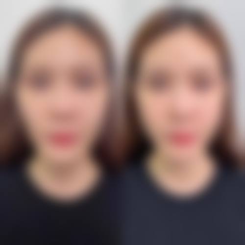 郑州都市风韵医疗美容医院患者口碑评价