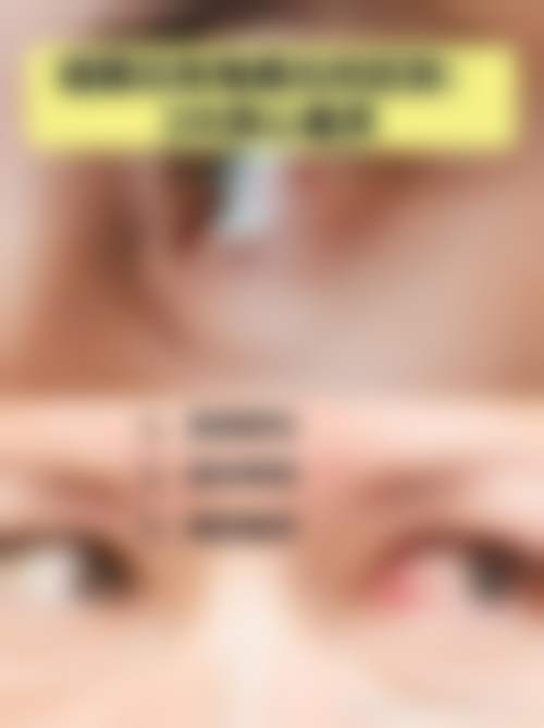 总结与预约号召:守护清晰视界从此刻开始