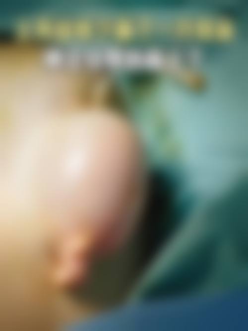 预约优惠活动:现在预约有什么补贴?