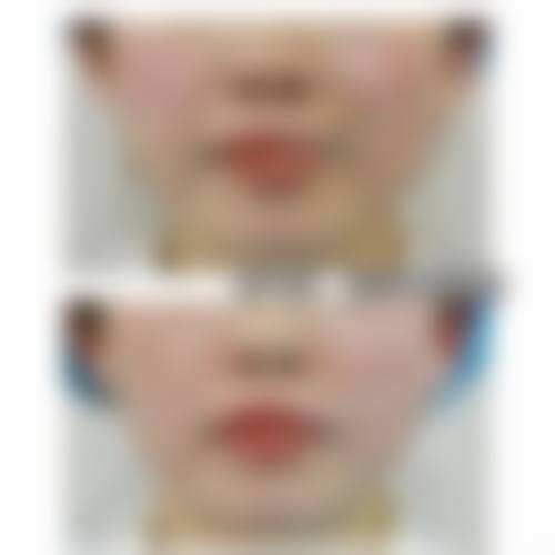 常见问题解答与预约指南