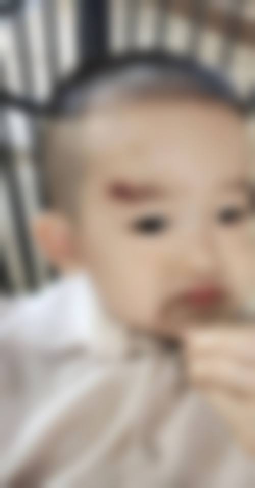 患者真实评价:玉林市第二人民医院眼科梁敏芝