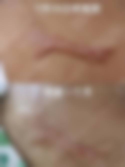 擅长项目详解