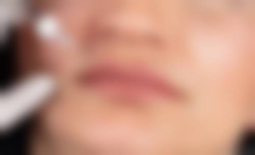 临床实例分享
