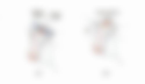 嘴巴往前凸怎么改善?不同矫正方式收费明细参考
