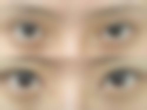 湖北省中医院整形美容科是正规的吗?