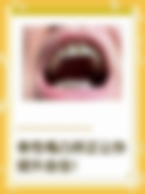 常见问题解答