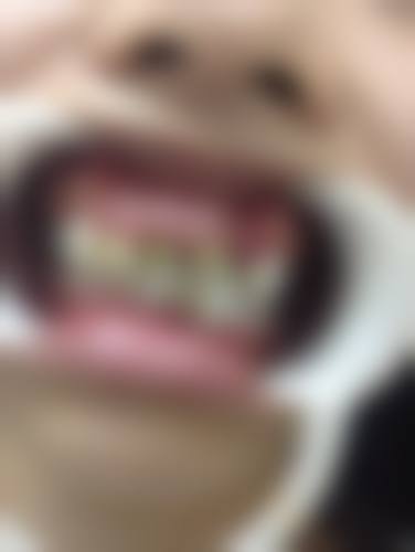 价格透明与优惠活动详情