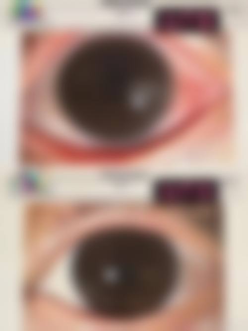 预约优惠活动：便捷通道与专属补贴